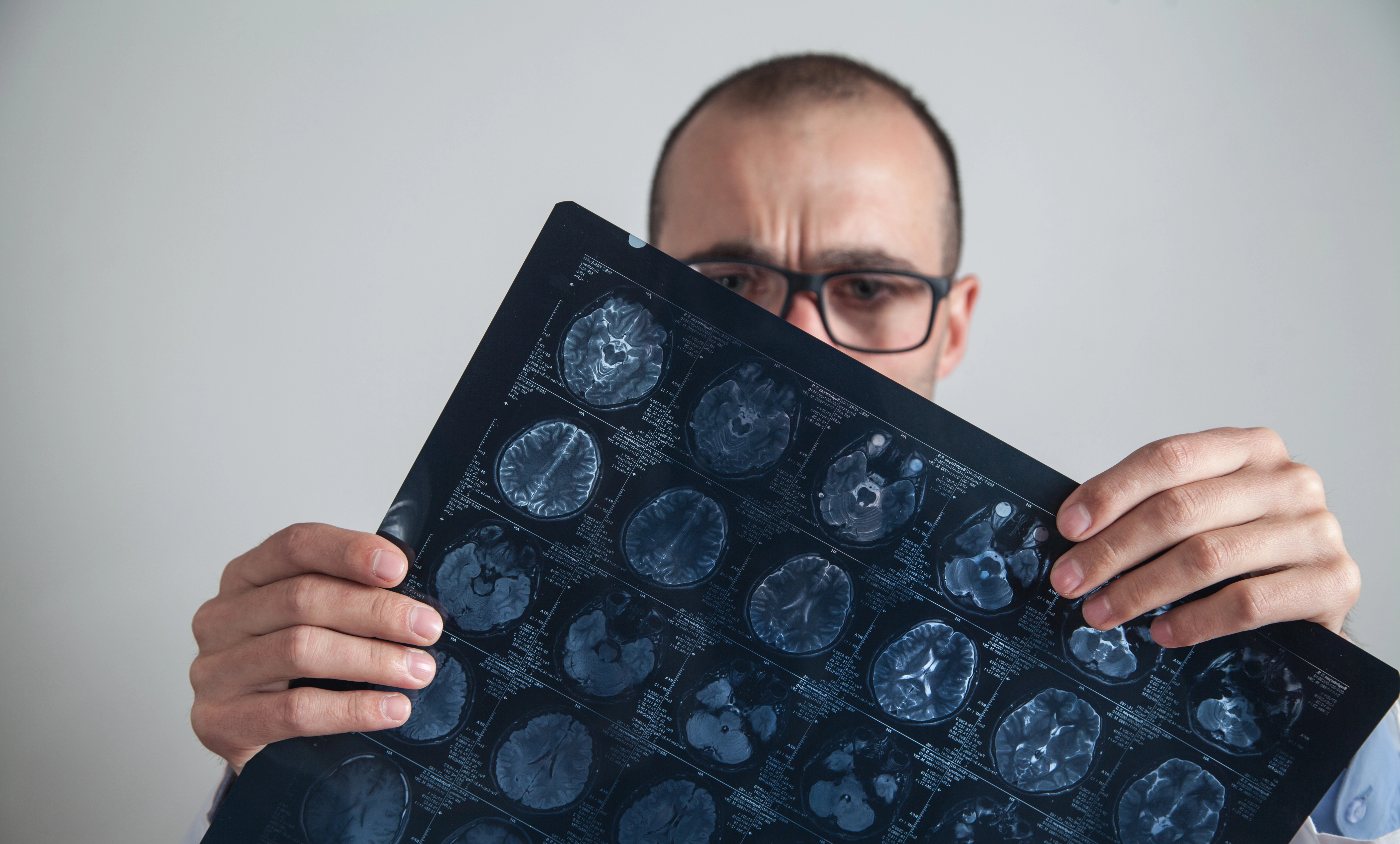 Neurological Symptoms